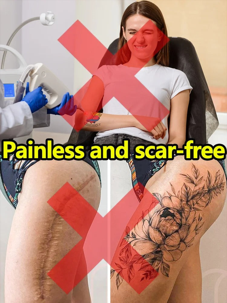 Tattoo Removal Laser Pen