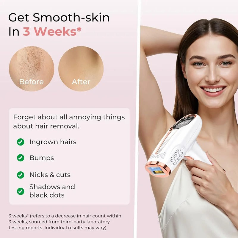 Permanent Laser Hair Removal