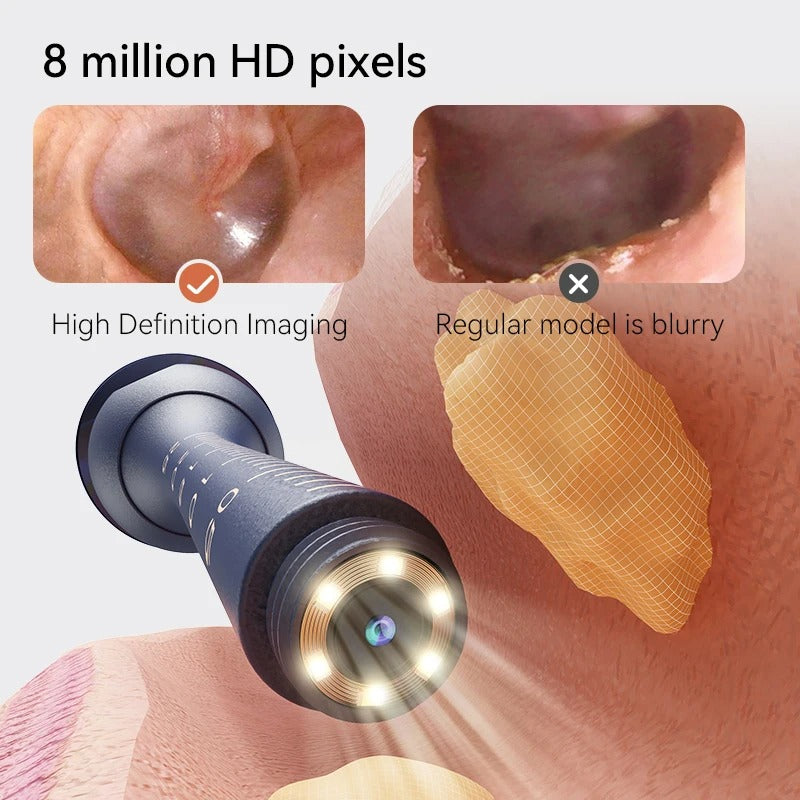 Smart Visual Ear Wax Cleaner 