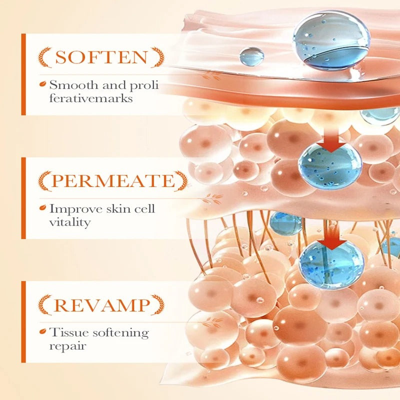 Permanent Stretch Marks Removal Cream 